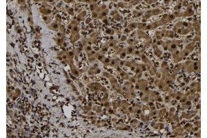 ABIN6276971 at 1/100 staining Human liver tissue by IHC-P. (FE65 antibody  (C-Term))