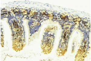 ABIN6276595 at 1/100 staining Mouse colon tissue by IHC-P.