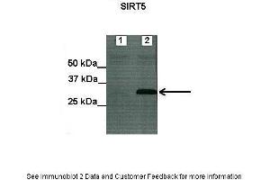Lanes:   Lane1: Untransfected HEK293T lysate Lane2: mSIRT5-FLAG transfected HEK293T lysate  Primary Antibody Dilution:   1:200  Secondary Antibody:   ProteinA-HRP  Secondary Antibody Dilution:   1:5000  Gene Name:   SIRT5  Submitted by:   Anonymous  There is BioGPS gene expression data showing that SIRT5 is expressed in HEK293T (SIRT5 antibody  (C-Term))