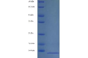 SDS-PAGE (SDS) image for S100 Calcium Binding Protein A8 (S100A8) (AA 2-89) protein (His tag) (ABIN5713804)