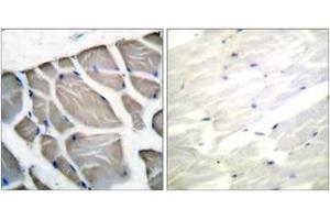 Immunohistochemistry analysis of paraffin-embedded human skeletal muscle tissue, using Actin-pan Antibody. (Actin antibody  (AA 326-375))