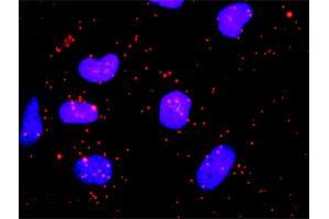 Proximity Ligation Analysis of protein-protein interactions between HIP1 and CLTC. (Clathrin Heavy Chain (CLTC) (AA 232-340) antibody)