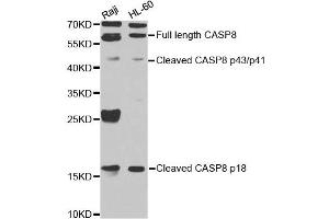 Western blot analysis of extracts of Raji cell and HL-60 cell line, using CASP8 antibody. (Caspase 8 antibody)