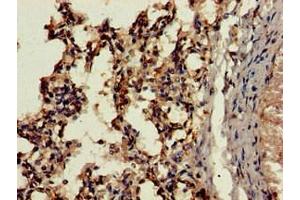 Immunohistochemistry of paraffin-embedded human lung tissue using ABIN7164288 at dilution of 1:100 (Cathepsin H antibody  (AA 116-219))