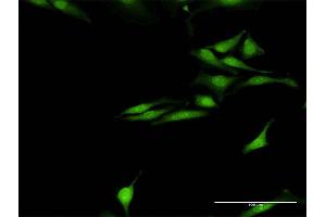 Immunofluorescence of purified MaxPab antibody to SNCG on HeLa cell. (SNCG antibody  (AA 1-127))