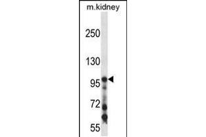 Western blot analysis in mouse kidney tissue lysates (35ug/lane). (COL1A1 antibody  (C-Term))