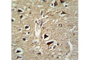IHC analysis of FFPE human brain tissue stained with PCSK2 antibody