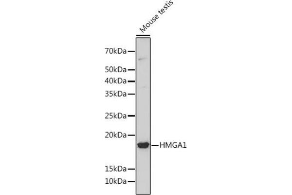 HMGA1 anticorps