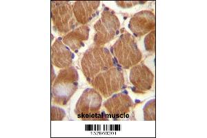 ASAM Antibody immunohistochemistry analysis in formalin fixed and paraffin embedded human skeletal muscle followed by peroxidase conjugation of the secondary antibody and DAB staining. (CLMP antibody  (AA 81-110))