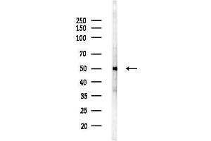 anti-Chemokine (C-C Motif) Receptor 8 (CCR8) (C-Term) antibody