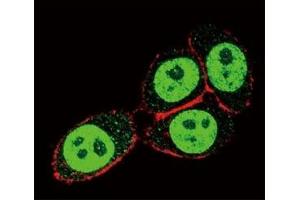 Confocal immunofluorescent analysis of SMAD3 antibody with HeLa cells followed by Alexa Fluor 488-conjugated goat anti-rabbit lgG (green). (SMAD3 antibody  (AA 186-215))