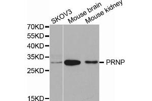 Western blot analysis of extracts of various cell lines, using PRNP antibody (ABIN5971407) at 1/1000 dilution. (PRNP antibody)