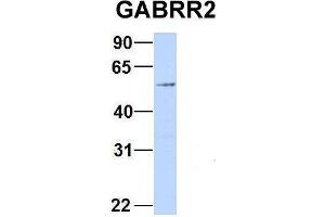 Host:  Rabbit  Target Name:  GABRR2  Sample Type:  293T  Antibody Dilution:  1. (GABRR2 antibody  (Middle Region))