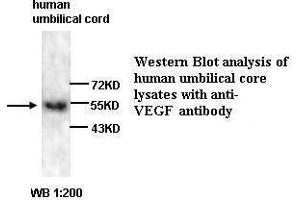 Western Blotting (WB) image for anti-Vascular Endothelial Growth Factor A (VEGFA) antibody (ABIN6583751)