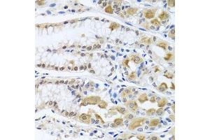 Immunohistochemistry of paraffin-embedded human stomach using TRMT1 antibody. (TRMT1 antibody  (AA 460-659))