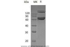 Ephrin B1 Protein (EFNB1) (His tag,Fc Tag)
