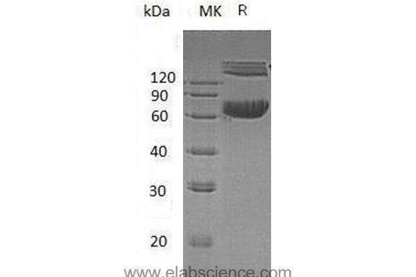 Ephrin B1 Protein (EFNB1) (His tag,Fc Tag)