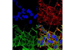Immunocytochemistry/Immunofluorescence analysis using Mouse Anti-SUR2A Monoclonal Antibody, Clone S319A-14 . (ABCC9 antibody  (AA 1505-1546) (HRP))
