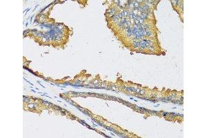 Immunohistochemistry of paraffin-embedded Human prostate using CXCL11 Polyclonal Antibody at dilution of 1:100 (40x lens). (CXCL11 antibody)