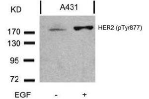 Image no. 3 for anti-Receptor tyrosine-protein kinase erbB-2 (ErbB2/Her2) (pTyr877) antibody (ABIN196749) (ErbB2/Her2 antibody  (pTyr877))