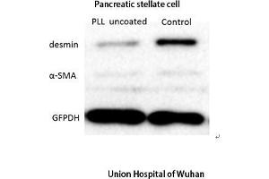 Western Blot (WB) analysis: Please contact us for more details. (Desmin antibody  (C-Term))