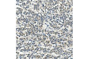 IHC analysis of LDLR using anti-LDLR antibody (ABIN7601438). (LDLR antibody  (AA 35-843))