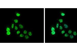 ICC/IF Image CDCA1 antibody [GT312] detects CDCA1 protein at cytoplasm and nucleus by immunofluorescent analysis. (NUF2 antibody)
