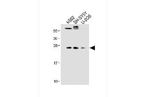 All lanes : Anti-N6T1 Antibody (N-term) at 1:2000 dilution Lane 1: K562 whole cell lysate Lane 2: SH-SY5Y whole cell lysate Lane 3: U-2OS whole cell lysate Lysates/proteins at 20 μg per lane. (N6AMT1 antibody  (N-Term))