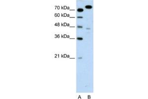 Western Blotting (WB) image for anti-Minichromosome Maintenance Complex Component 3 (MCM3) antibody (ABIN2461390) (MCM3 antibody)