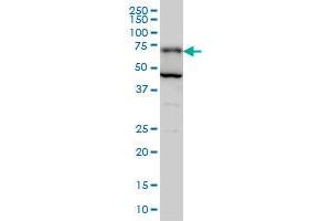 PGM2 monoclonal antibody (M05), clone 1A3 Western Blot analysis of PGM2 expression in Hela S3 NE .