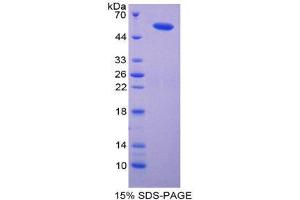 SDS-PAGE (SDS) image for Importin 8 (IPO8) (AA 417-622) protein (His tag,GST tag) (ABIN2123002)