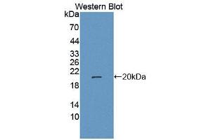 Figure. (LRRFIP1 antibody  (AA 615-735))