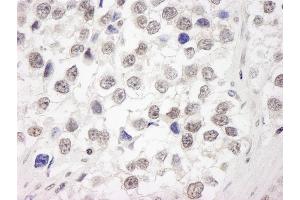Immunohistochemistry (IHC) image for anti-Ubiquitin Interaction Motif Containing 1 (UIMC1) (C-Term) antibody (ABIN7449010) (UIMC1 antibody  (C-Term))