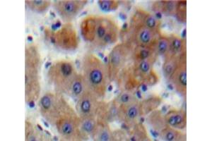 Used in DAB staining on fromalin fixed paraffin-embedded Liver tissue (DVL1 antibody  (AA 150-332))