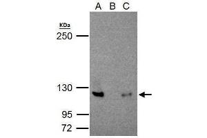 IP Image NFkB p100/p52 antibody immunoprecipitates NFkB p100/p52 protein in IP experiments. (NFKB2 antibody  (C-Term))