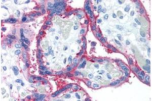 Human Placenta (formalin-fixed, paraffin-embedded) stained with CD59 antibody ABIN241558 at 10 ug/ml followed by biotinylated anti-mouse IgG secondary antibody ABIN481714, alkaline phosphatase-streptavidin and chromogen. (CD59 antibody)