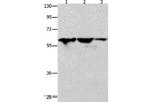 Western blot analysis of Human seminoma tissue, HT-29 and A549 cell, using DNAJC7 Polyclonal Antibody at dilution of 1:400 (DNAJC7 antibody)
