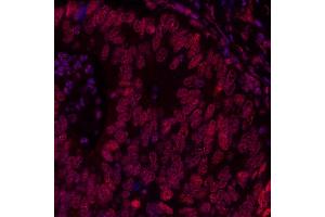 Immunofluorescence (IF) image for anti-Bromodomain Containing 3 (BRD3) (AA 676-726) antibody (ABIN7455203) (Recombinant BRD3 antibody  (AA 676-726))