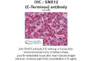 Image no. 1 for anti-Sorting Nexin 12 (SNX12) (C-Term) antibody (ABIN1739487) (SNX12 antibody  (C-Term))