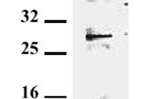 Detection of endogenous tollip in murine EL-4. (TOLLIP antibody)