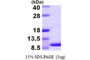 SDS-PAGE (SDS) image for Chemokine (C-C Motif) Ligand 15 (CCL15) (AA 22-113) protein (ABIN666800)