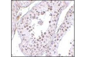 Immunohistochemistry of MED4 in human testis tissue with this product at 10 μg/ml.