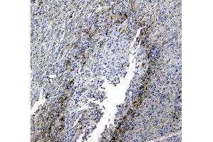 IHC analysis of Synaptotagmin 1 using anti-Synaptotagmin 1 antibody . (SYT1 antibody)