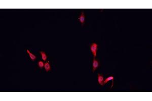 Immunofluorescence (fixed cells) (IF/ICC) image for anti-Cullin 2 (CUL2) (C-Term) antibody (ABIN6261115)