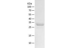 Western Blotting (WB) image for Transcription Elongation Factor A (SII), 3 (TCEA3) (AA 1-299) protein (His tag) (ABIN7287293) (TCEA3 Protein (AA 1-299) (His tag))