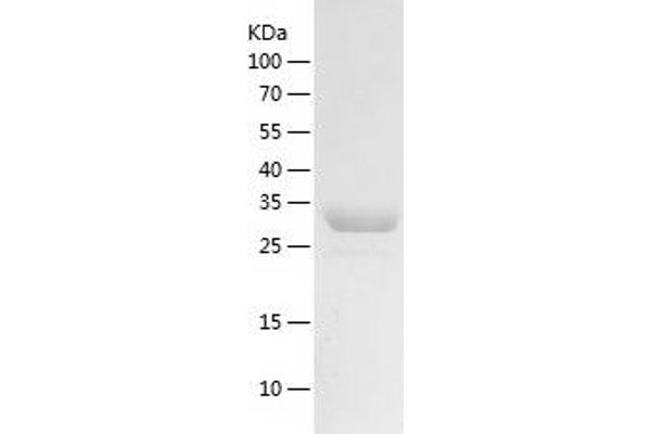 TCEA3 Protein (AA 1-299) (His tag)