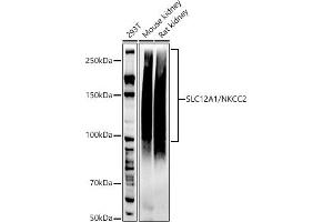 Western blot analysis of extracts of various cell lines, using SLC12/NKCC2 antibody (ABIN7270400) at 1:1000 dilution. (SLC12A1 antibody)