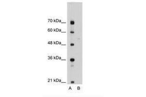 Image no. 2 for anti-Sep (O-phosphoserine) tRNA:Sec (Selenocysteine) tRNA Synthase (SEPSECS) (AA 61-110) antibody (ABIN6736318) (SEPSECS antibody  (AA 61-110))