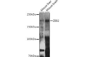 Western blot analysis of extracts of various cell lines, using ZEB2 antibody (ABIN6131480, ABIN6150424, ABIN6150425 and ABIN6221369) at 1:500 dilution. (ZEB2 antibody  (AA 1050-1214))