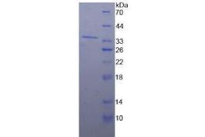 SDS-PAGE analysis of Human Nucleoporin 98 kDa Protein.